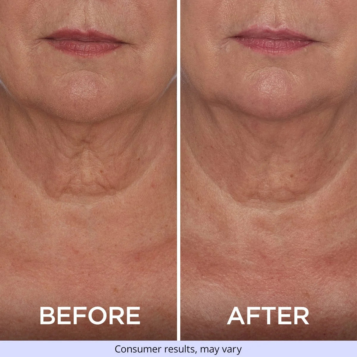 Tighten & Lift Neck Cream