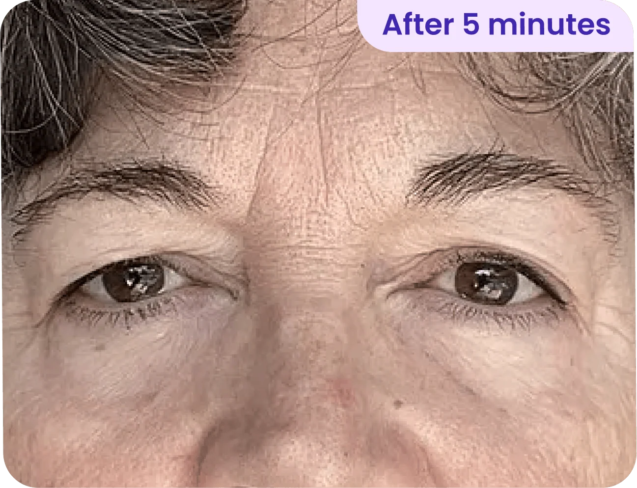 A close-up of a person's face focusing on their eyes and forehead, showing subtle lines and texture of the skin. The person has a light complexion, with light brown hair. The eyes are brown, and there are visible signs of aging, including fine lines. In the top right corner, there is text that says "After 5 minutes."