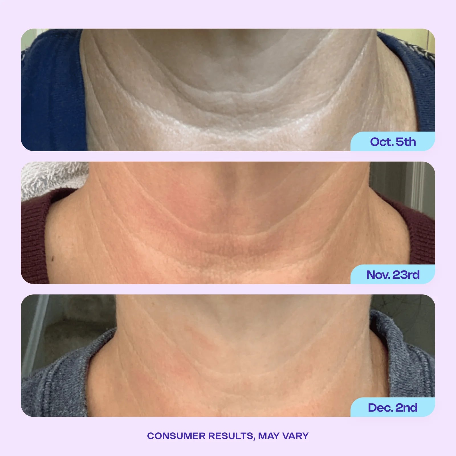 Renewal Duo