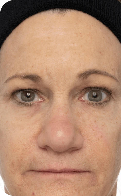 A close-up of a middle-aged person’s face, showing natural skin texture with various freckles and light wrinkles. The person has straight brown hair covered by a black headband. Their expression is neutral, with grayish-blue eyes looking directly at the camera. The light is evenly distributed, highlighting facial features such as the nose, cheekbones, and lips. The background is a soft, blurred gradient that emphasizes the face.