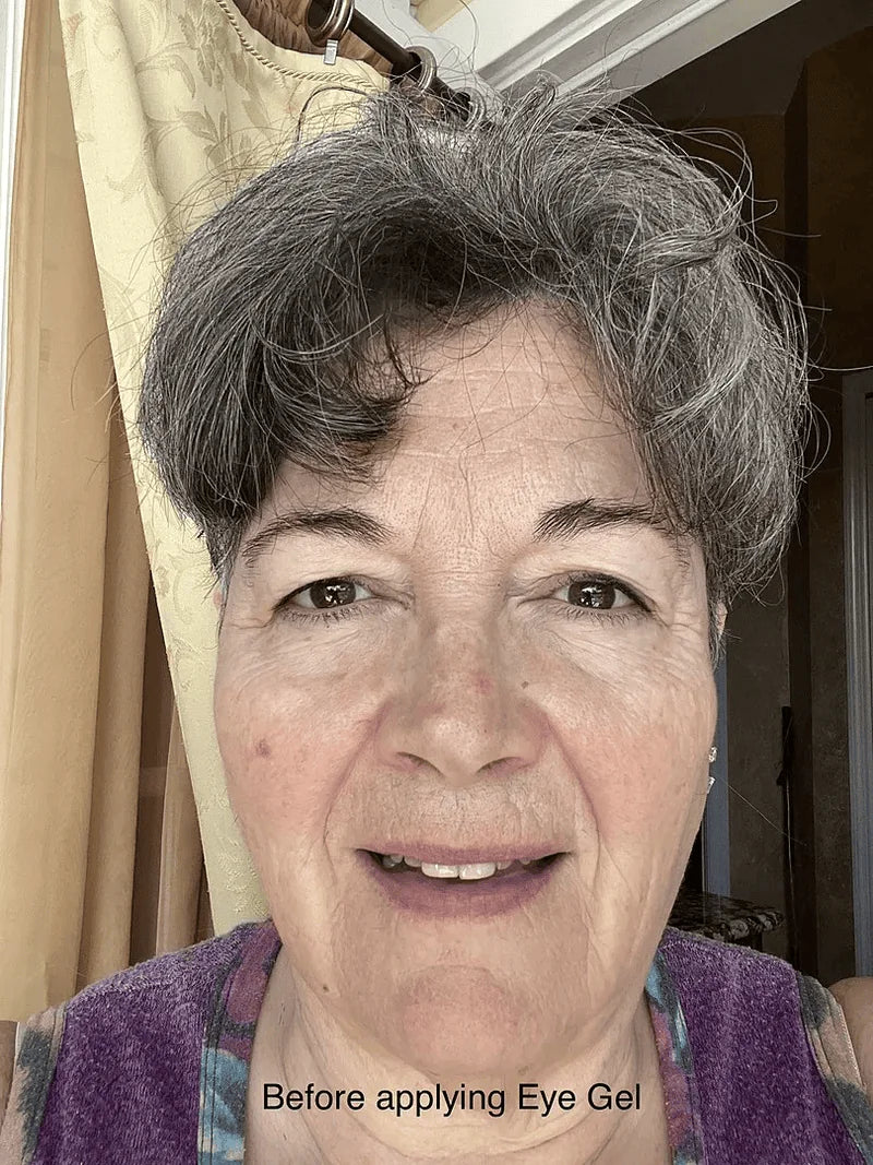 An older woman with short gray hair stands in front of a window with yellow curtains, smiling at the camera. She has a light complexion and is wearing a colorful sleeveless top. The background shows a glimpse of a room and a door. The text at the bottom of the image reads, "Before applying Eye Gel." The lighting is natural and warm, highlighting her facial features.
